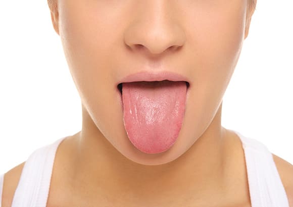 舌痛症・ドライマウス